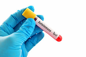 ¿Sabes qué son las enfermedades autoinmunes?