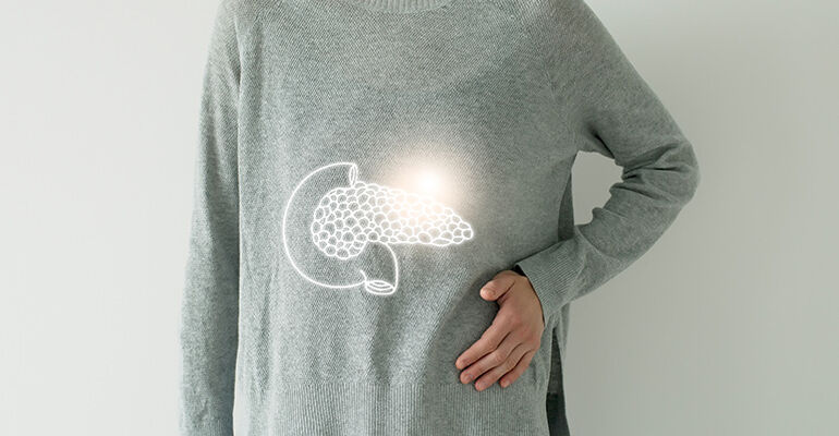 Vinculan los niveles altos de insulina de la diabetes tipo 2 y el cáncer de páncreas