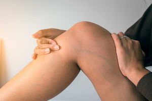 Varices: pautas para combatirlas en verano