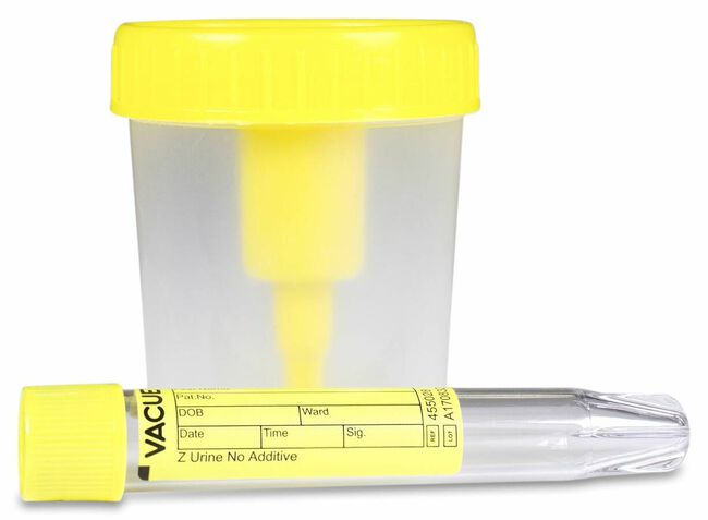 imagen de Envase Orina Vac&iacute;o + Tubo, 1 Ud