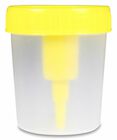 Miniatura de imagen de Apos&aacute;n Envase Vac&iacute;o para Muestra de Orina, 1 Ud