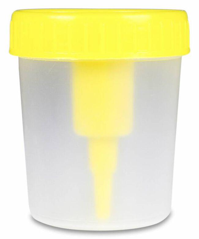 imagen de Apos&aacute;n Envase Vac&iacute;o para Muestra de Orina, 1 Ud