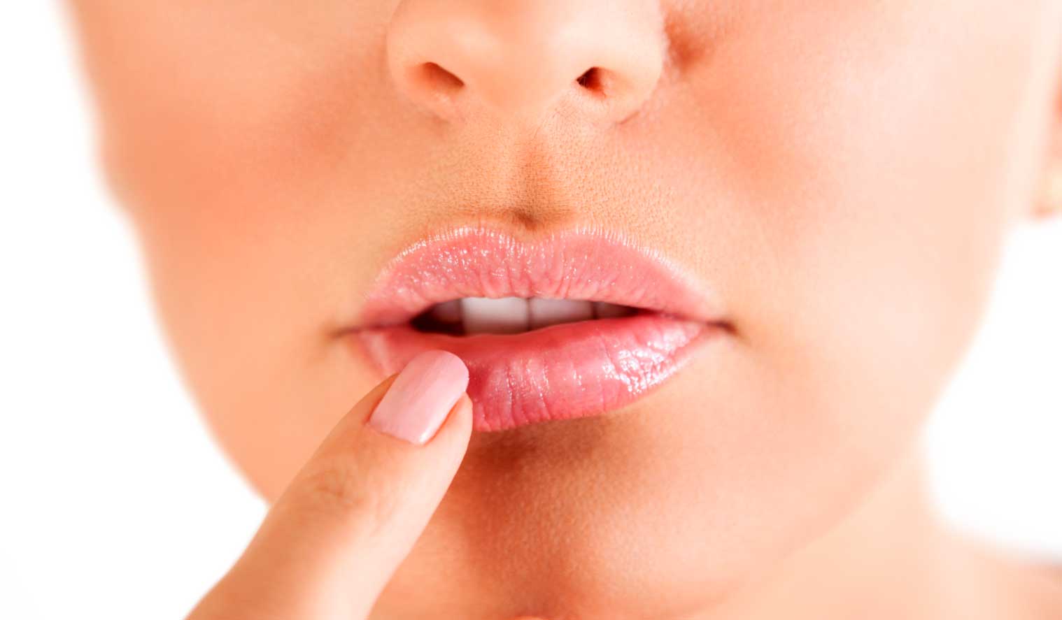 Herpes labial: por qué sale y cómo prevenirlo