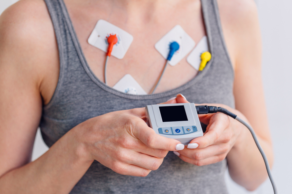 ¿Qué es un Holter y cómo se realiza la prueba?